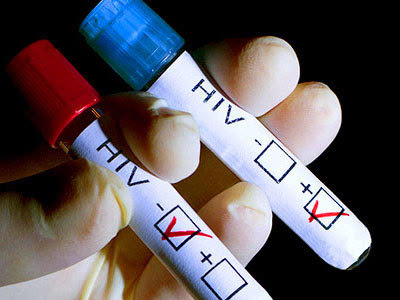 观察--NEJM:与HIV抗争战场应从实验室走出去