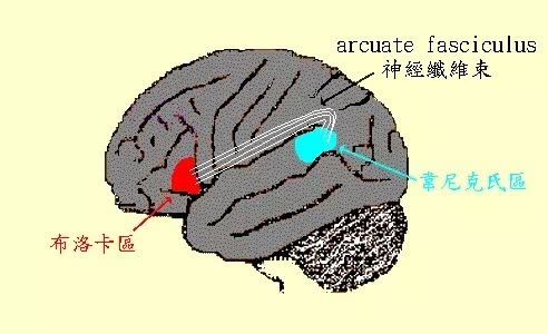 韦尼克区的损伤,将产生严重的感觉性失语症.