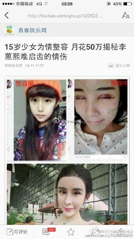 李蒽熙狂整容震惊网友抢曹赢心男友洪尧遭炮轰