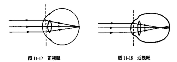 为什么近视眼的人眯眼就可以看得更清楚