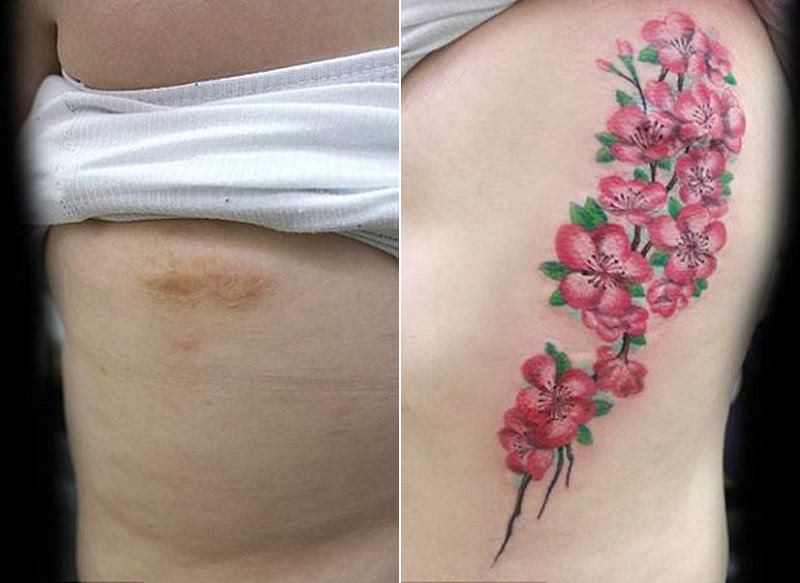 巴西艺术家为家暴受害者免费纹身 伤疤变鲜花