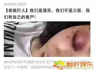 在我倒下之后,她甚至像疯狗一样的咬我",这打就算了,竟然还动嘴咬人