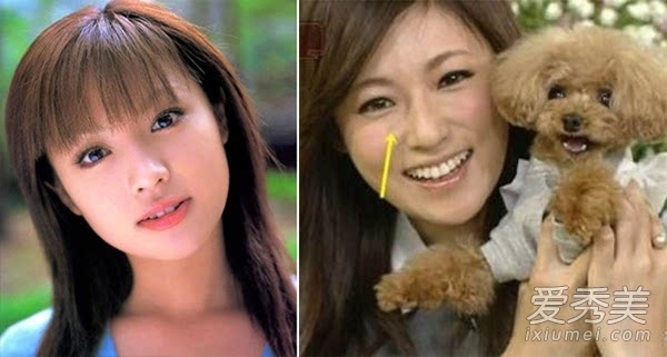 日本明星整容更疯狂人造假脸美丑两极化