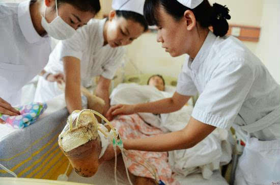 天津医科大学总医院接受伤员48名 已有3人出院