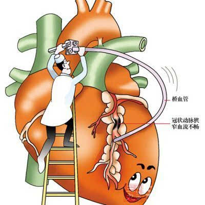 心病,对于患者的生命健康,时时刻刻都有威胁,说不定什么时候突然发作