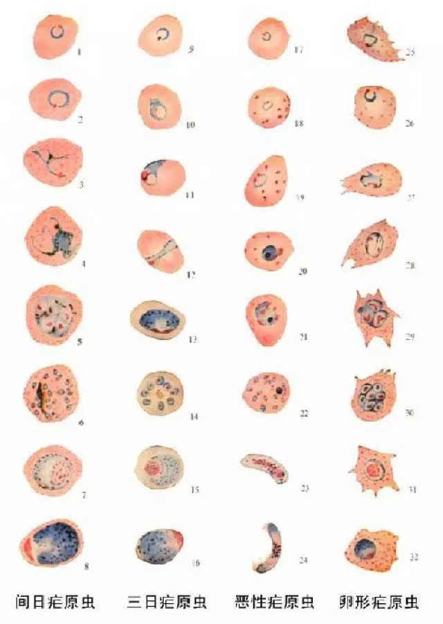 ▍四种疟原虫在红细胞内的各期形态