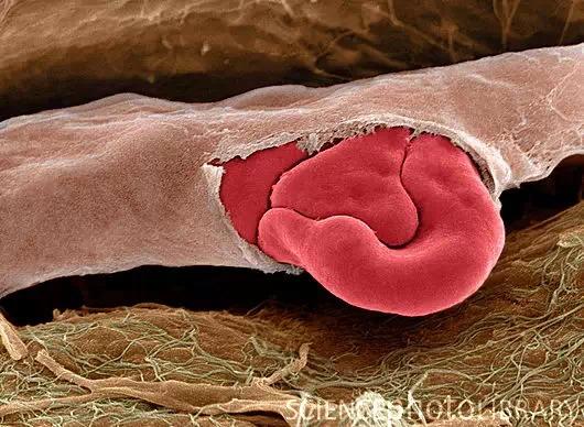 奇妙的人体血管,不是水管