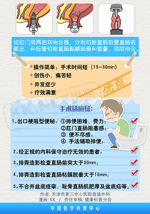 starr手术:不开刀治便秘便秘,是每个人都可能遇到的问题,一般情况下