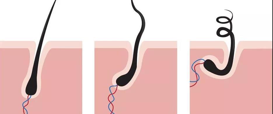 每天掉多少头发算正常?看完终于放心了
