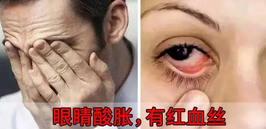 用它敷一敷就够了!随时随地给眼睛做spa