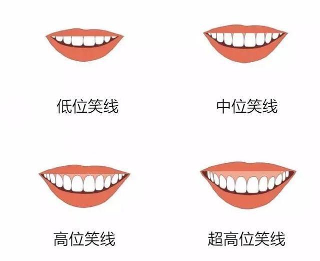 angelababy演技差是因为嘴型?如何通过练习打造"微笑唇"?