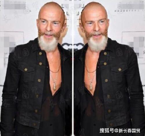 章子怡55岁前外籍男友近照,剃光头大胡子花白,今昔判若两人