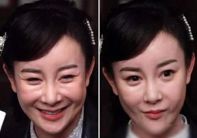 消失的姚芊羽,整容到底是如何毁掉一位好女孩的?