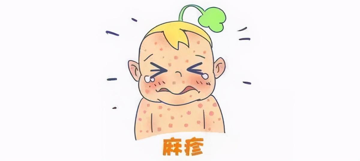 得了麻疹该怎么办?