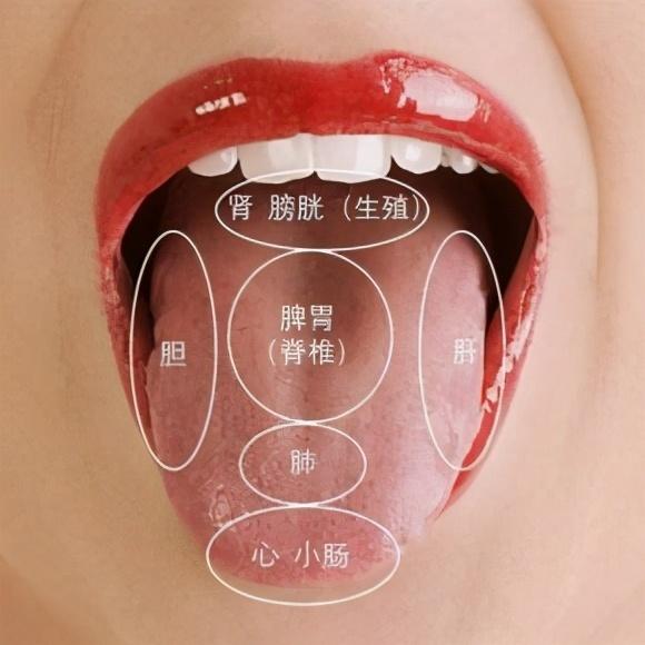 中医专家表示,肝郁湿热也会导致齿痕舌