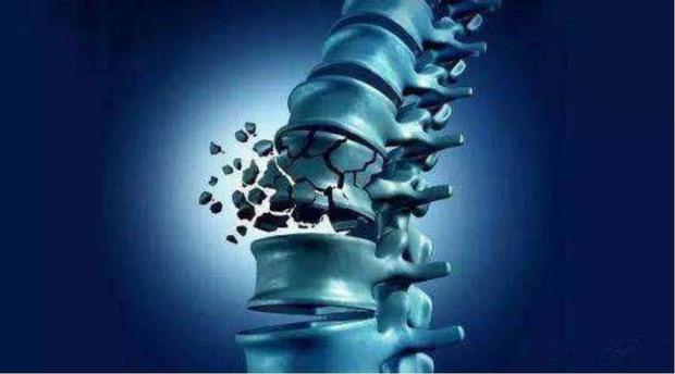 刷个牙结果腰断了,打个喷嚏竟然骨折了……罪魁祸首就是它!