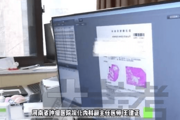 女儿癌症晚期,问题竟在爸爸身上！医生打开腹腔又合上,全是肿瘤没法手术…