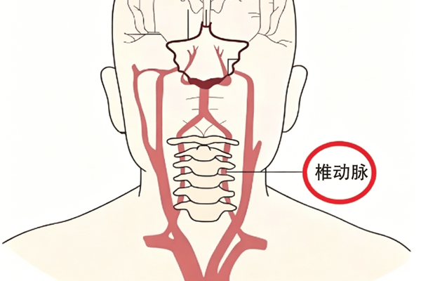 用这种枕头可能损伤脑血管 专家：一个拳头高度最安全