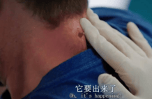 一只蛆爬进了他的肉里，他决定把蛆生下来