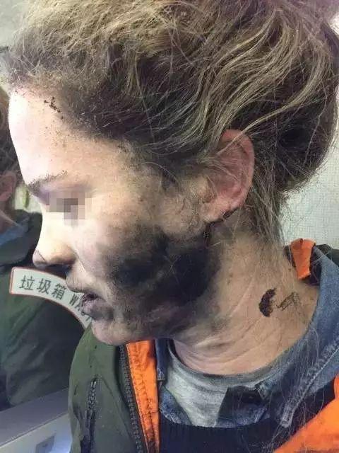 警惕耳机在耳中熔化17岁少女身亡她当时正在