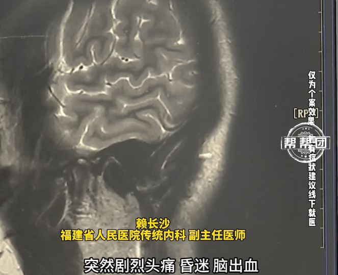 绿豆汤当水连喝三天，女子血压飙升，突发脑出血昏迷！医生提醒
