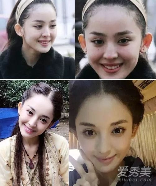 孙俪下巴痣巩俐媒婆痣 女星脸上"美痣"有啥寓意