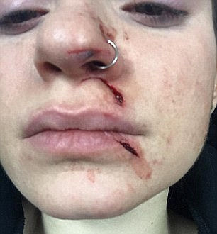 纽约出现割脸狂魔 受害者缝150针面部瘫痪