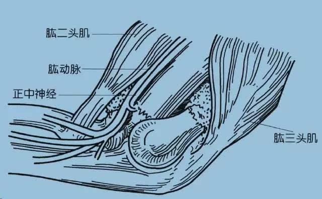 30~50°):是容易發生肱骨髁上骨折的解剖因素圖 1 肘關節解剖示意圖