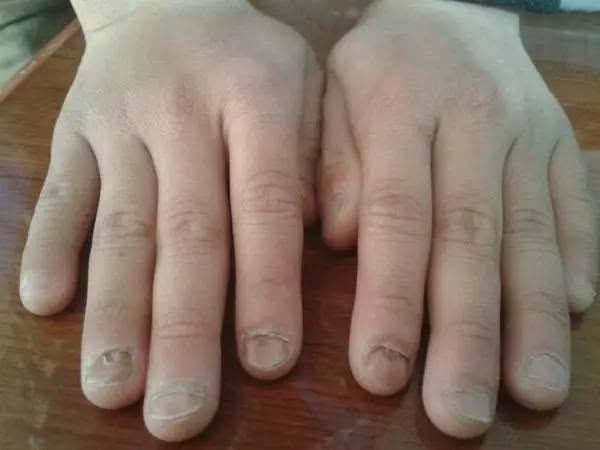 啃手指头的危害的图片图片