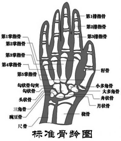 尺骨远端骨骺图片