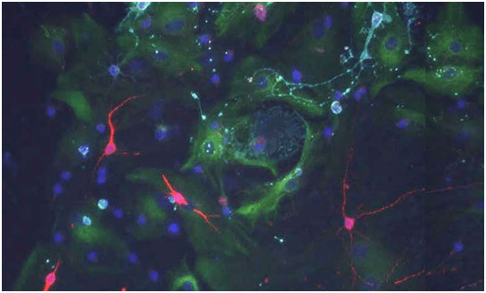 cell stem cell:常被人忽视的脉络丛竟能调控大脑中的神经干细胞