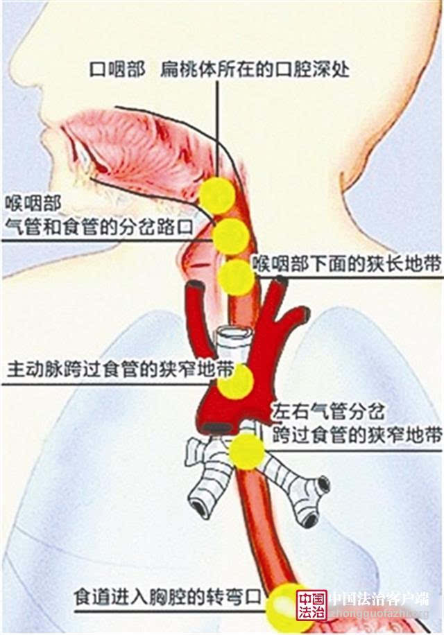 食管生理狭窄图片