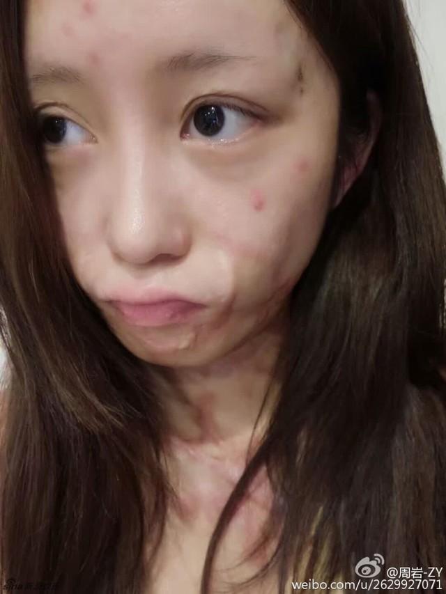 烧伤女孩周岩旧照甜美清纯 性格坚强阳光