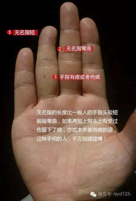 如果再加上指头上有受过伤留下了疤