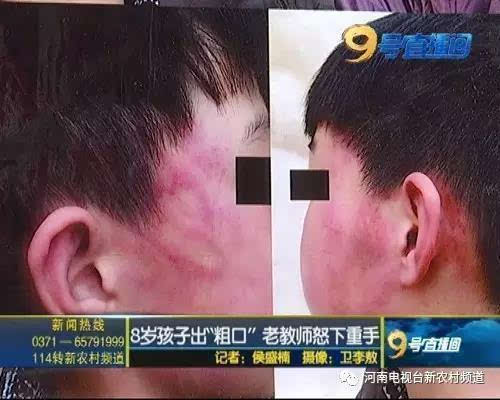 学生骂老师被掌掴教龄30年为何下狠手