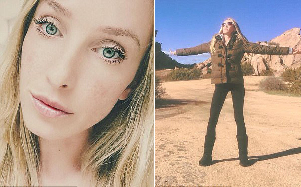 美嵌合体模特拥有两种肤色两套免疫系统