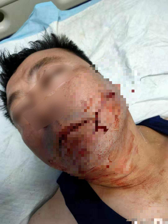 近日,一条名为"陕西榆林市子洲县交警在饭店用菜刀砍人"的帖子热传.