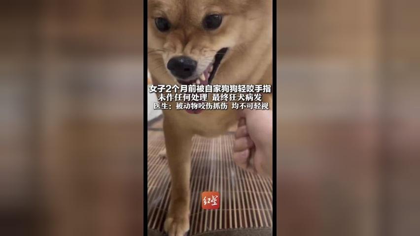 女子2个月前被自家狗狗轻咬手指 未作任何处理 最终狂犬病发 医生：被动物咬伤抓伤 均不可轻视 狂犬病病死率几乎100%