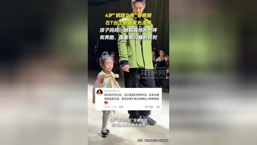 4岁钢腿女孩穿着假肢自信走秀