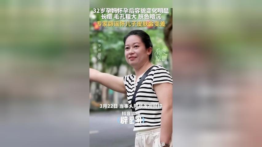 怀儿子孕妇会变丑？32岁孕妈怀孕后容貌变化明显，长痘变黑、毛孔粗大，专家回应