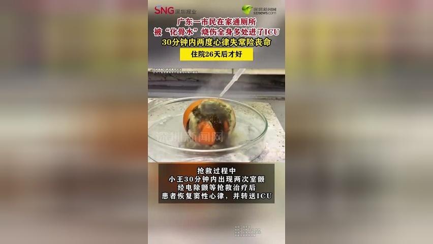 广东一市民在家通厕所被“化骨水”烧伤，进了ICU