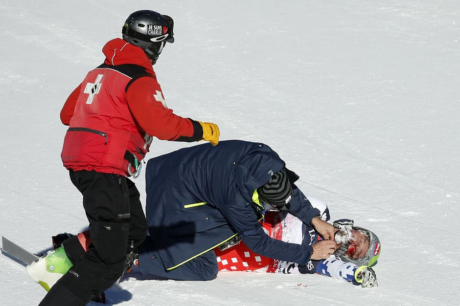 现场:高山滑雪世锦赛选手摔伤 脸上是血陷昏迷