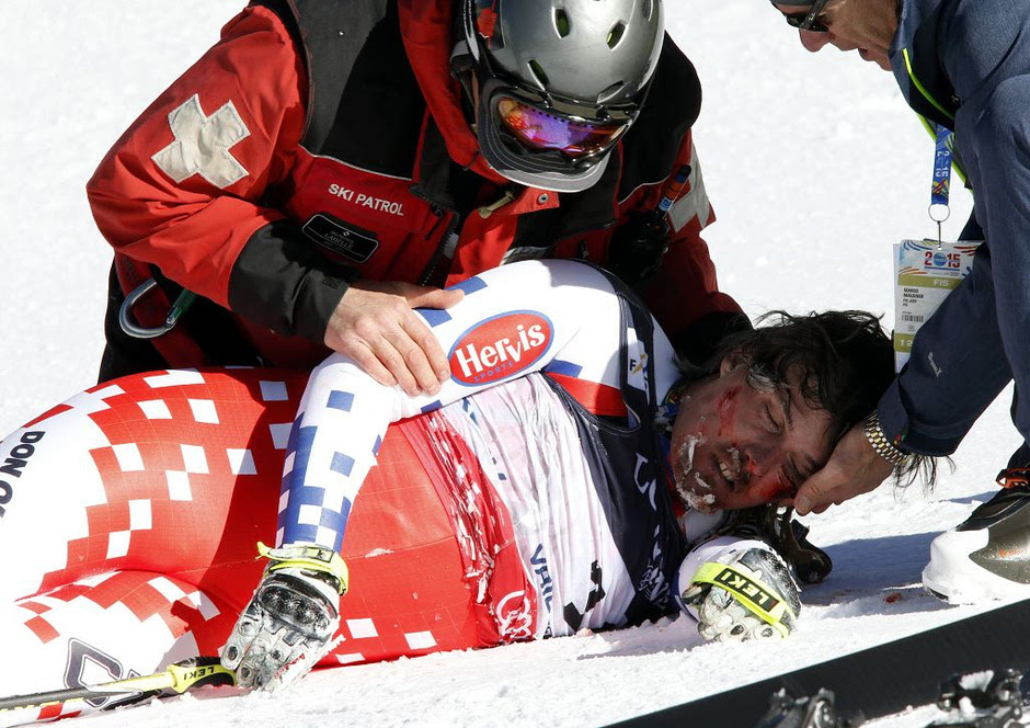 现场:高山滑雪世锦赛选手摔伤 脸上是血陷昏迷