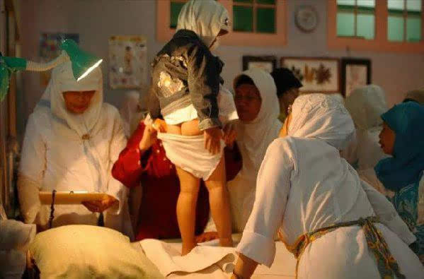 女性割礼步骤实拍图片