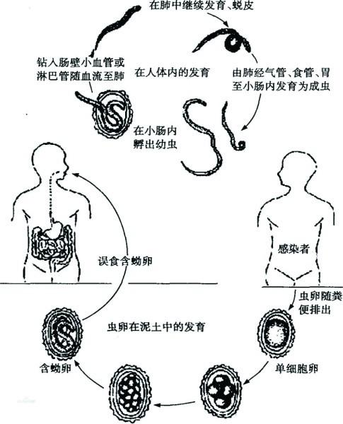 肠道寄生虫种类图片
