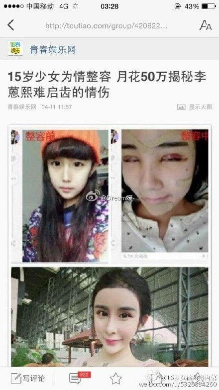 15岁女孩李蒽熙danae狂整容震惊网友 抢曹赢心男友遭炮轰