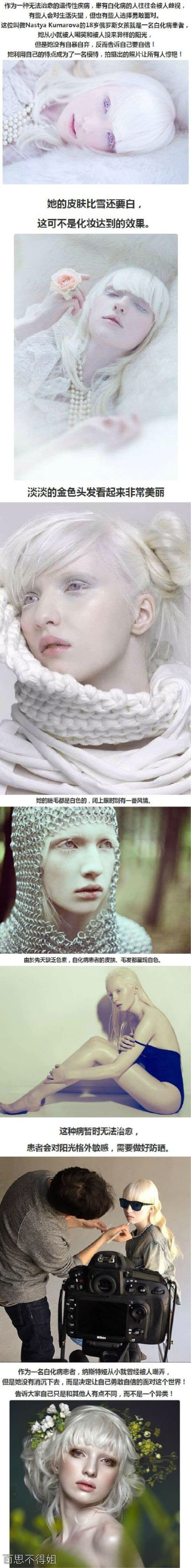 我家这有个得白化病的女孩 眼睛没什么问题啊 就是头发睫毛都是浅黄的