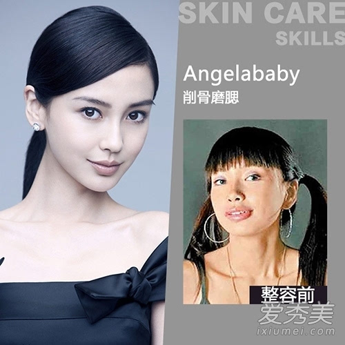 angelababy整容前照片曝光 丑小鸭变天鹅