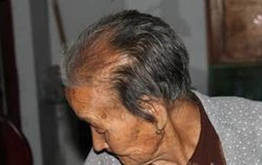 104岁老人长黑发换新牙 看看老人都吃什么
