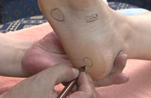 女人脚底生殖腺疼图片